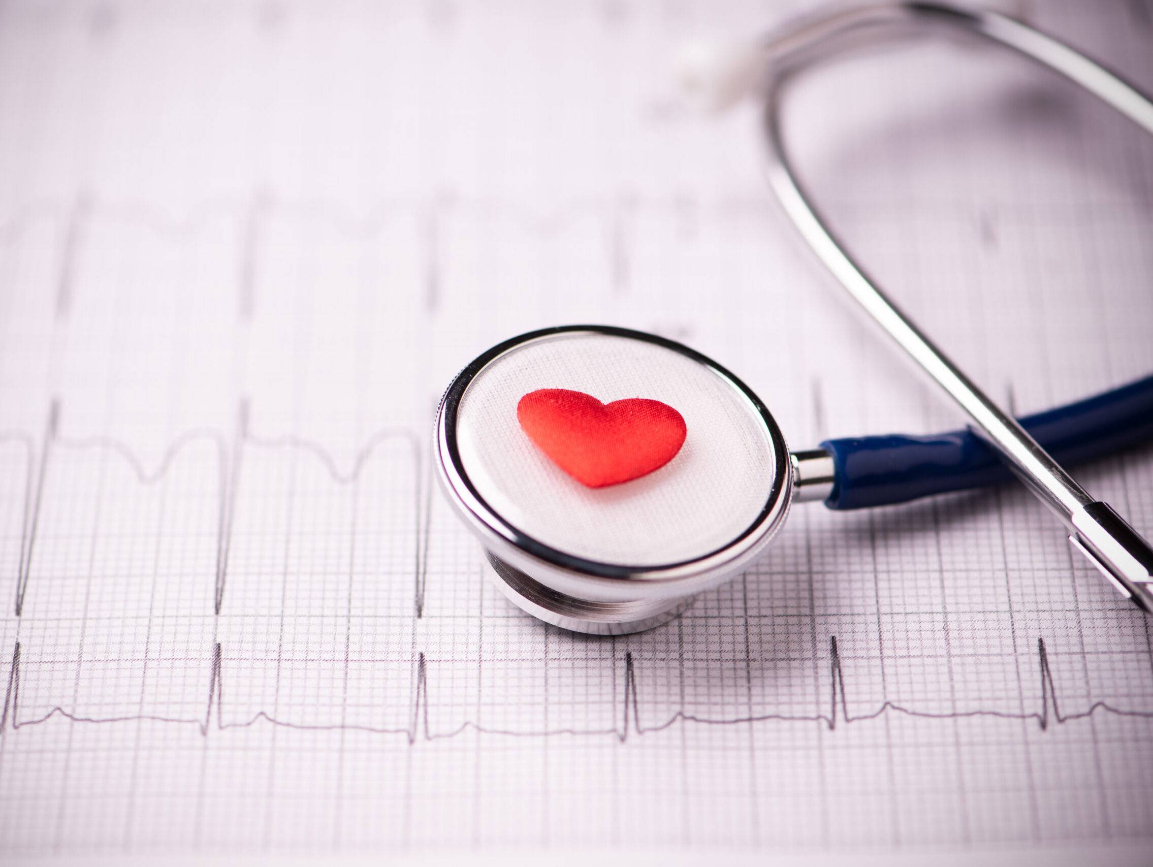 EKG spoczynkowe